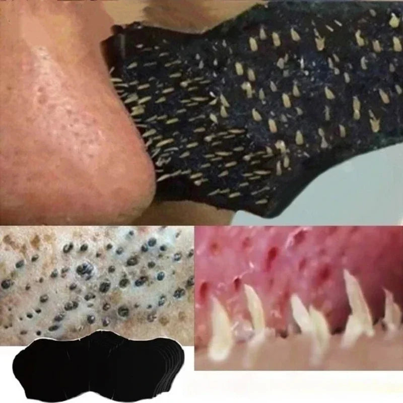 Mascarilla Nasal para Eliminar Espinillas – Tiras Limpieza de Poros y Puntos Negros